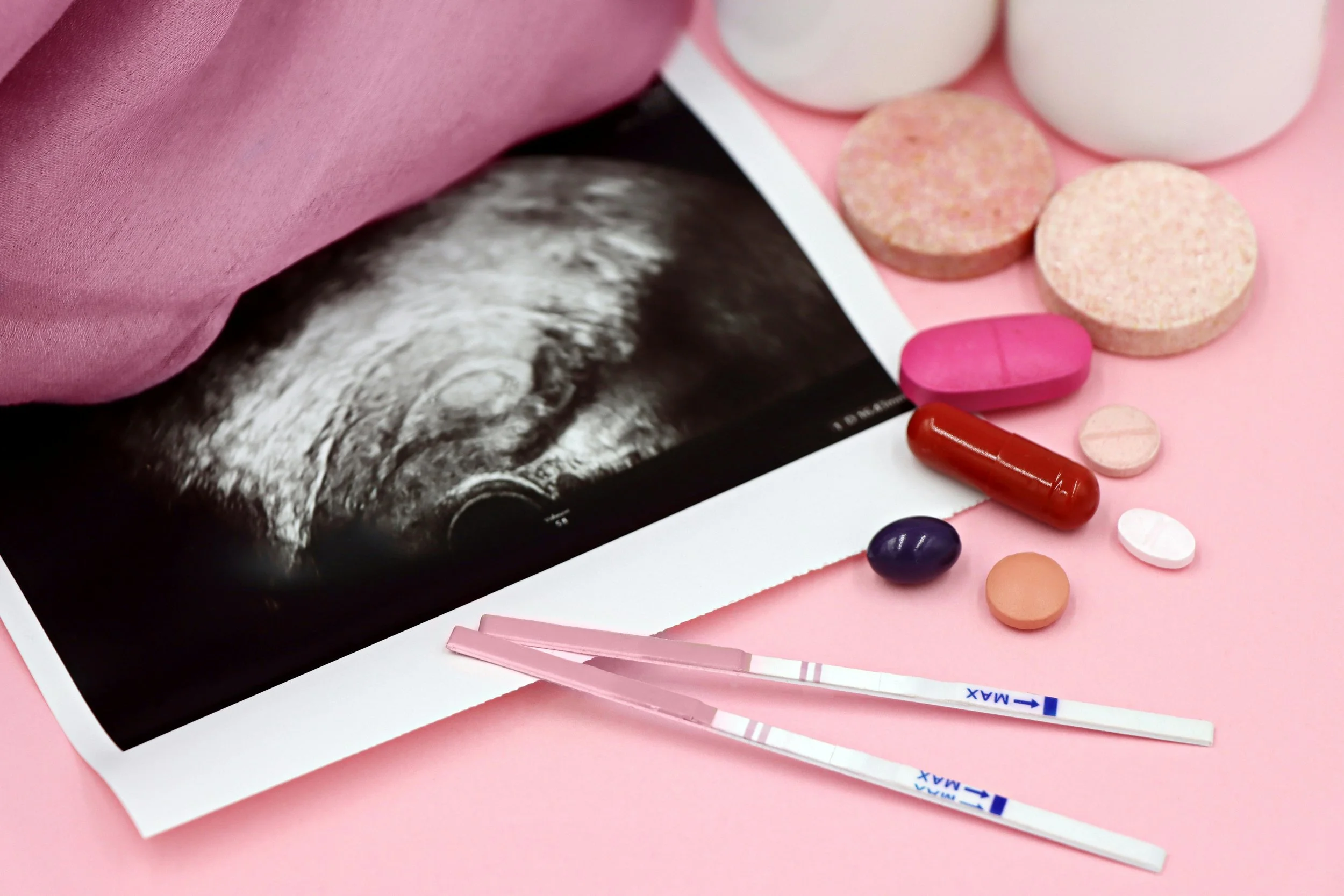Ultrasound image with pregnancy tests and supplements on a pink background